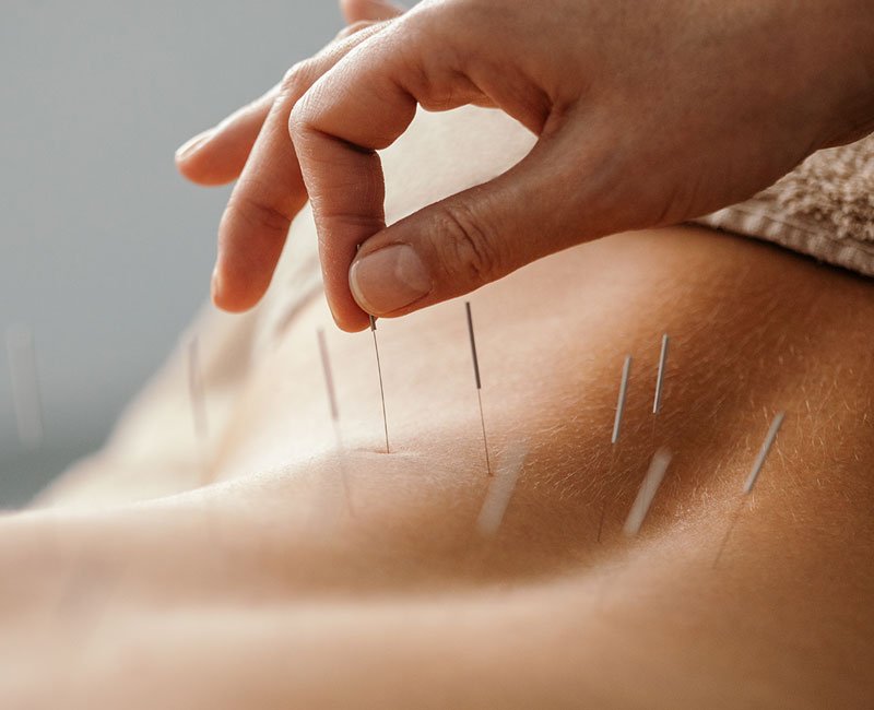 Bao Xin Acupuncture & Chinese Medicine Clinic Bentleigh