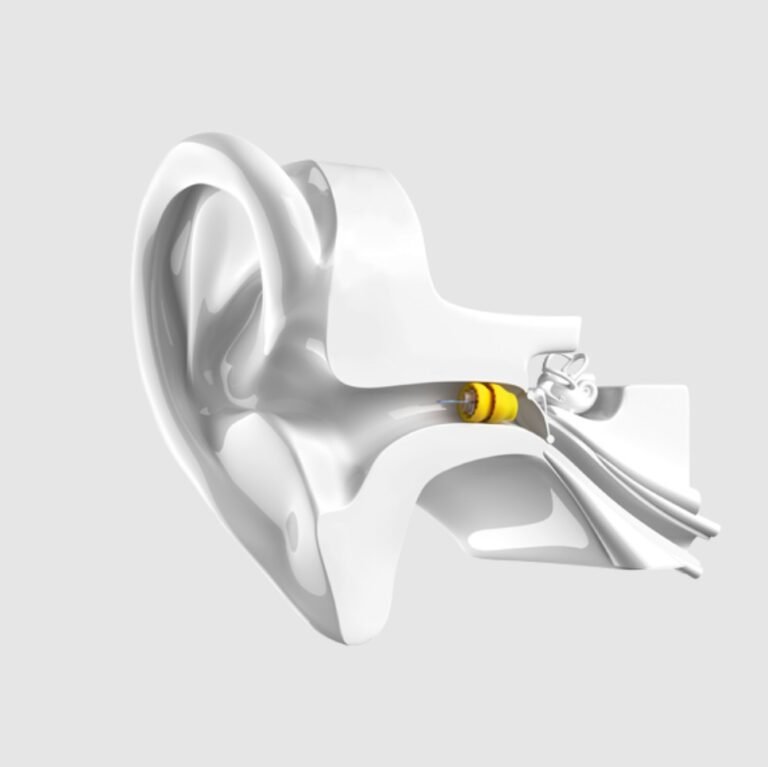 Connect Hearing Bentleigh